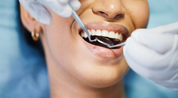 Best Emergency Tooth Extraction in Shenandoah, PA